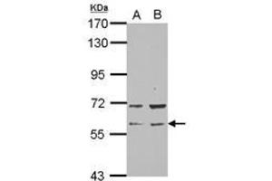 Image no. 2 for anti-RAP1, GTP-GDP Dissociation Stimulator 1 (RAP1GDS1) (N-Term) antibody (ABIN1494067)