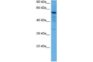 Host:  Mouse  Target Name:  SOX9  Sample Tissue:  Mouse Brain  Antibody Dilution:  1ug/ml (SOX9 antibody  (N-Term))