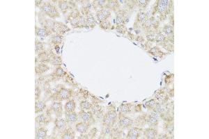 Immunohistochemistry of paraffin-embedded mouse liver using SAA3 antibody. (Serum Amyloid A3 Pseudogene (SAA3P) antibody)