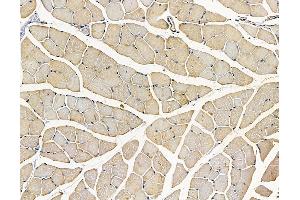 ABIN7096942 and ABIN7101008 at 1/100 staining mouse muscle tissue by IHC-P. (C22orf9 antibody)