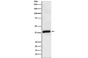 Western blot analysis of APOL1 expression in Human plasma cell lysate.