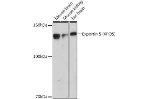 Western blot analysis of extracts of various cell lines, using Exportin 5 (XPO5) (XPO5) Rabbit mAb (ABIN1682763, ABIN3018126, ABIN3018127 and ABIN7101577) at 1:1000 dilution. (XPO5 antibody)