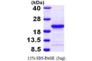 SDS-PAGE (SDS) image for Prefoldin Subunit 4 (PFDN4) (AA 1-134) protein (His tag) (ABIN667869)