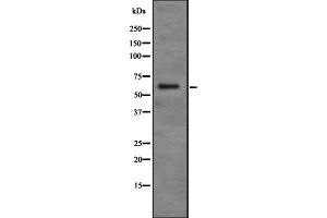 Western blot analysis of PDP2 expression in Jurkat cell lysate,The lane on the left is treated with the antigen-specific peptide. (PDP2 antibody  (N-Term))