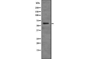 Western blot analysis of PDP2 expression in Jurkat cell lysate,The lane on the left is treated with the antigen-specific peptide.