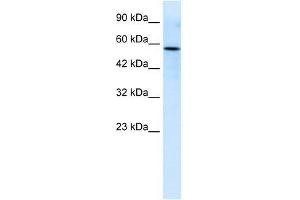 Human Jurkat; WB Suggested Anti-RIPX Antibody Titration: 0. (RUFY3 antibody  (C-Term))