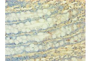 Immunohistochemistry of paraffin-embedded human colon tissue using ABIN7160897 at dilution of 1:50 (NDUFA3 antibody  (AA 2-84))