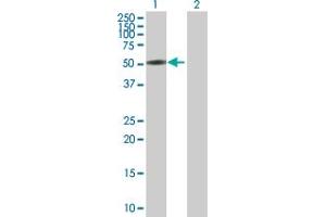 Western Blot analysis of CTNNA3 expression in transfected 293T cell line by CTNNA3 MaxPab polyclonal antibody. (CTNNA3 antibody  (AA 1-516))