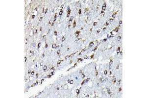 Immunohistochemistry of paraffin-embedded rat brain using TTC11/FIS1 antibody (ABIN7267209) at dilution of 1:100 (40x lens). (Fission 1 antibody)