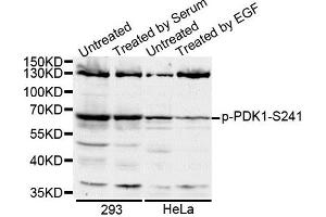 Western blot analysis of extracts of various cell lines, using Phospho-PDK1-S241 antibody. (PDPK1 antibody  (pSer241))