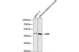 Western blot analysis of extracts of various cell lines using FIBP Polyclonal Antibody at dilution of 1:1000. (FIBP antibody)
