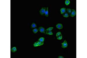 Immunofluorescent analysis of PC-3 cells using ABIN7143660 at dilution of 1:100 and Alexa Fluor 488-congugated AffiniPure Goat Anti-Rabbit IgG(H+L) (ALDH1A3 antibody  (AA 2-210))