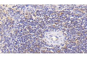 Detection of IL18 in Human Spleen Tissue using Monoclonal Antibody to Interleukin 18 (IL18) (IL-18 antibody  (AA 94-193))