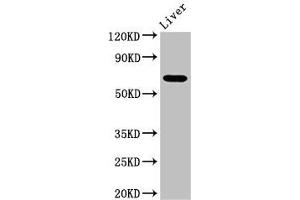 Western Blot Positive WB detected in: Mouse liver tissue All lanes: SENP2 antibody at 3. (SENP2 antibody  (AA 138-324))
