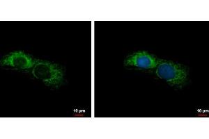 ICC/IF Image ALDH7A1 antibody detects ALDH7A1 protein at mitochondria by immunofluorescent analysis. (ALDH7A1 antibody)