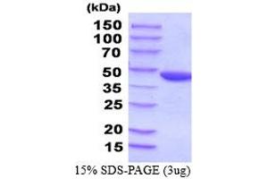 SDS-PAGE (SDS) image for Phosphoglycerate Kinase 2 (PGK2) (AA 1-417) (Active) protein (His tag) (ABIN5854495) (PGK2 Protein (AA 1-417) (His tag))