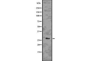 Western blot analysis of BCL2A1 using Jurkat whole  lysates. (BCL2A1 antibody  (Internal Region))