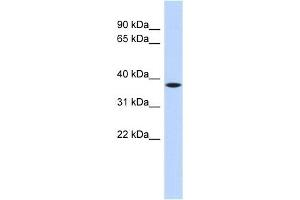 C22ORF30 antibody used at 1 ug/ml to detect target protein. (C22ORF30 antibody  (Middle Region))