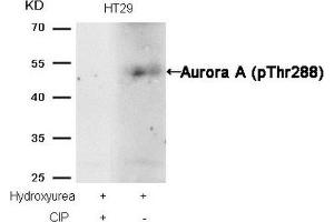 Western blot analysis of extracts from HT29 cells, treated with Hydroxyurea or calf intestinal phosphatase (CIP), using Aurora A (phospho-Thr288) Antibody. (Aurora A antibody  (pThr288))