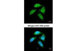 ICC/IF Image Immunofluorescence analysis of paraformaldehyde-fixed HeLa, using CtBP1, antibody at 1:200 dilution. (CTBP1 antibody  (Center))