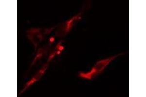 ABIN6275614 staining  LOVO cells by IF/ICC. (UBASH3A antibody  (Internal Region))