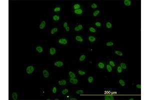 Immunofluorescence of monoclonal antibody to SURB7 on HeLa cell. (MED21 antibody  (AA 1-144))