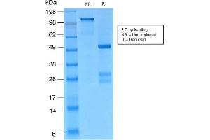 SDS-PAGE Analysis Purified Catenin, gamma Rabbit Monoclonal Antibody (CTNG/2155R).