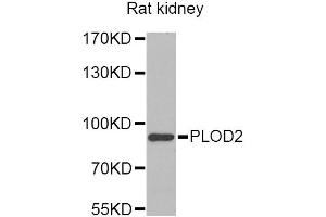 Western blot analysis of extracts of rat kidney, using PLOD2 Antibody.