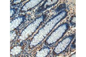 IHC-P analysis of Human Rectum Tissue, with DAB staining. (CHI3L1 antibody  (AA 112-377))