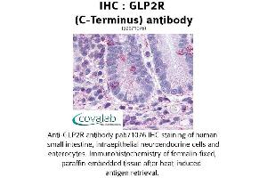 Image no. 1 for anti-Glucagon-Like Peptide 2 Receptor (GLP2R) (C-Term) antibody (ABIN1734731) (GLP2R antibody  (C-Term))