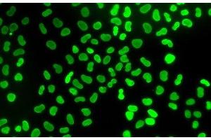 Immunofluorescence analysis of U2OS cells using TMPO Polyclonal Antibody (Thymopoietin antibody)