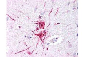Immunohistochemical (Formalin/PFA-fixed paraffin-embedded sections) staining in human putamen (neurons and glia) with GPR52 polyclonal antibody . (GPR52 antibody)