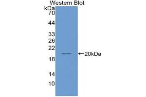 Western blot analysis of the recombinant protein. (HNF1B antibody  (AA 159-300))