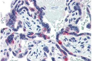 Human Placenta (formalin-fixed, paraffin-embedded) stained with SIN3A antibody ABIN462178 followed by biotinylated goat anti-rabbit IgG secondary antibody ABIN481713, alkaline phosphatase-streptavidin and chromogen. (SIN3A antibody  (N-Term))