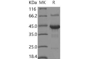 Western Blotting (WB) image for Shisa Homolog 3 (SHISA3) protein (Fc Tag) (ABIN7317032)