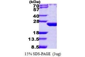 SDS-PAGE (SDS) image for ADP Ribosylation Factor Like GTPase 6 (ARL6) (AA 1-186) protein (His tag) (ABIN667468)