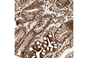 Immunohistochemical staining of human stomach with TAPBP polyclonal antibody  shows strong cytoplasmic and membranous positivity in glandular cells at 1:20-1:50 dilution. (TAPBP antibody)