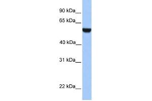 WB Suggested Anti-PHF17 Antibody Titration:  0. (PHF17 antibody  (C-Term))