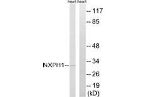 Western Blotting (WB) image for anti-Neurexophilin 1 (NXPH1) (AA 77-126) antibody (ABIN2879190) (Neurexophilin 1 antibody  (AA 77-126))