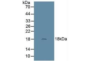 Detection of ADM in Rat Brain Tissue using Polyclonal Antibody to Adrenomedullin (ADM) (Adrenomedullin antibody  (AA 22-147))