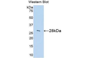Western blot analysis of the recombinant protein. (IGFBP2 antibody  (AA 35-304))