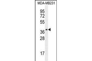 PRSS3 Antibody (N-term) (ABIN654446 and ABIN2844180) western blot analysis in MDA-M cell line lysates (35 μg/lane).