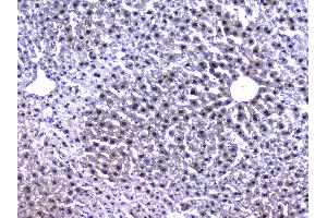 IHC analysis of RXRA using anti-RXRA antibody . (Retinoid X Receptor alpha antibody  (AA 226-462))