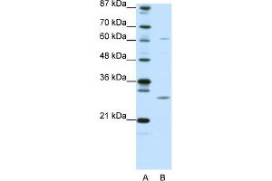 WB Suggested Anti-CRSP9 Antibody Titration:  0. (MED7 antibody  (N-Term))