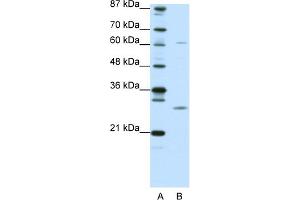 WB Suggested Anti-CRSP9 Antibody Titration:  0.