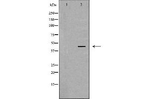 Western blot analysis of MCF7 cell lysate, using LHX8 Antibody. (LHX8 antibody  (Internal Region))