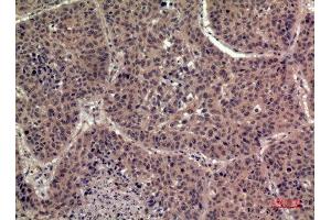 Immunohistochemistry (IHC) analysis of paraffin-embedded Human Lung, antibody was diluted at 1:100. (FIL1h antibody  (Internal Region))