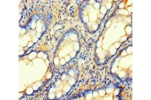 Immunohistochemistry of paraffin-embedded human small intestine tissue using ABIN7145543 at dilution of 1:100 (BCMO1 antibody  (AA 1-300))