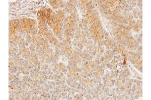 IHC-P Image Immunohistochemical analysis of paraffin-embedded SW480 xenograft, using Seladin 1, antibody at 1:100 dilution. (Seladin 1 antibody)