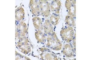 Immunohistochemistry of paraffin-embedded human stomach using BAG5 antibody (ABIN5975259) at dilution of 1/100 (40x lens). (BAG5 antibody)